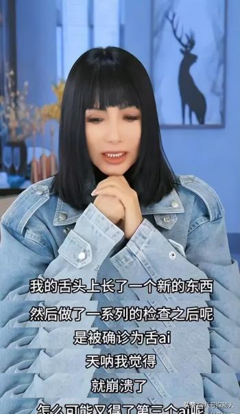 三次患癌，明明是歌手却要被切掉半个舌头，张咪：我无法再唱歌了  -图22