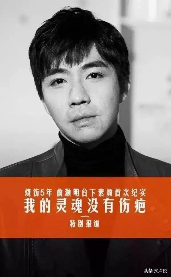 俞灏明疑烧伤时被杨幂“抛弃”：有一种人逆袭起来，连自己都怕！  -图5